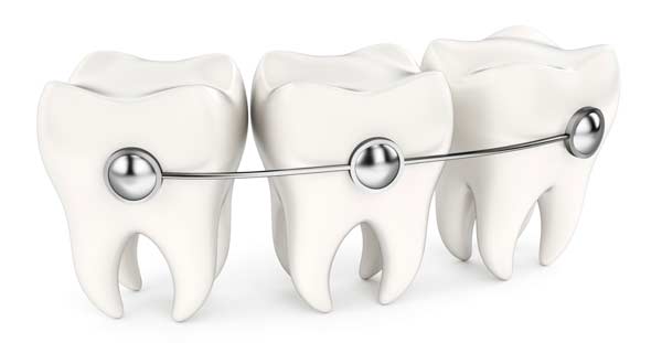 OrthoSolutions